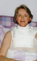 Photo  of neck burn  post radiotherapy and covered in dressings