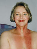 Photo of neck burns 15 day after radiotherapy