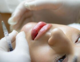 history of plastic surgery